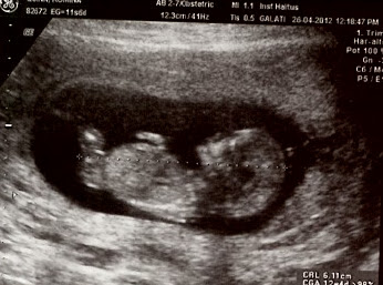 Embarazo 12 semanas 4 dias
